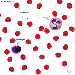 Typical Blood Smear